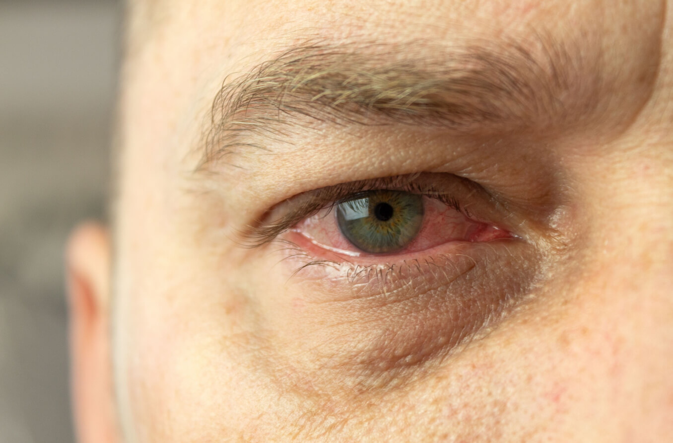 imagen estilizada de una persona con ojos rojos
