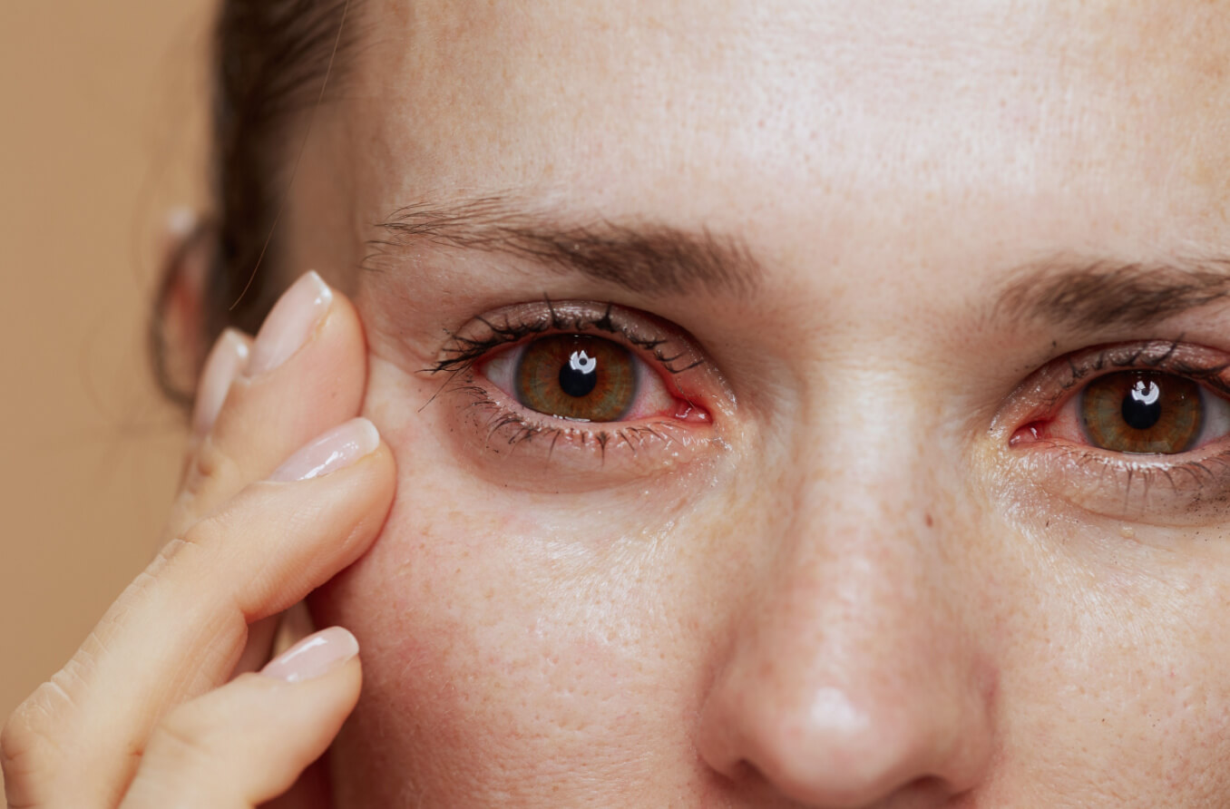 Lista de verificación que indica el riesgo de síndrome de Sjogren