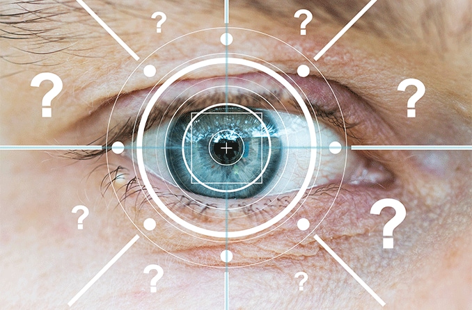 ¿Cuánto dura la queratomileusis in situ asistida con láser (LASIK)? ¿Es permanente?