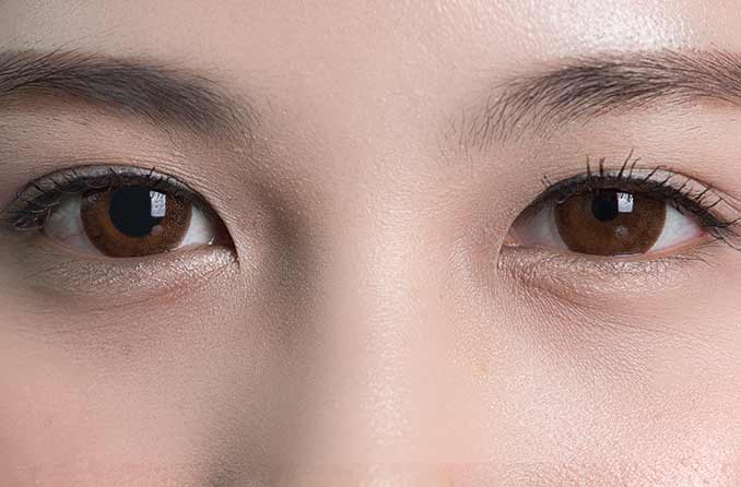 瞳孔大小不均(不相等的瞳孔大小)