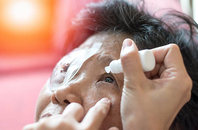 白內障成因、症狀、類型和治療