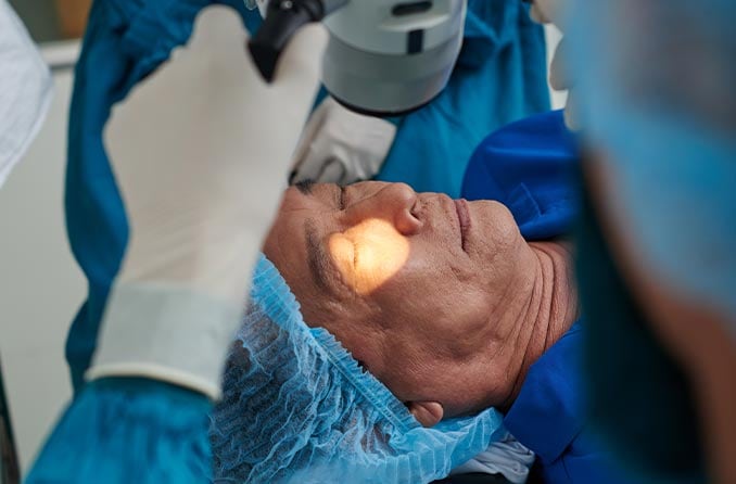 白內障手術：應知事項