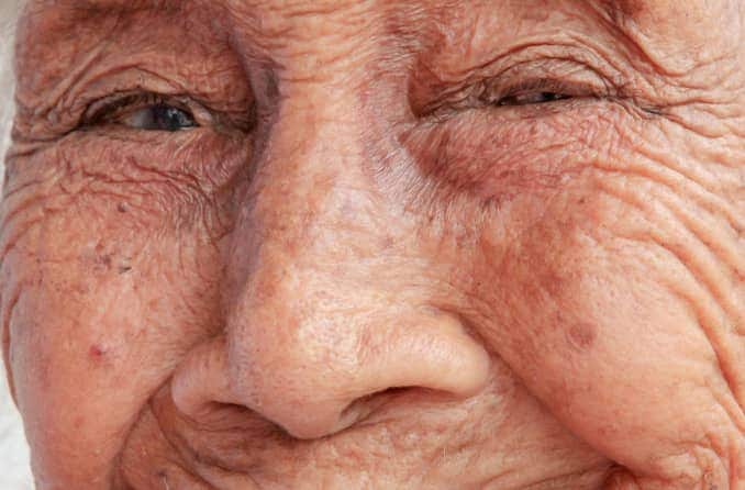 白內障手術後併發症 | All About Vision