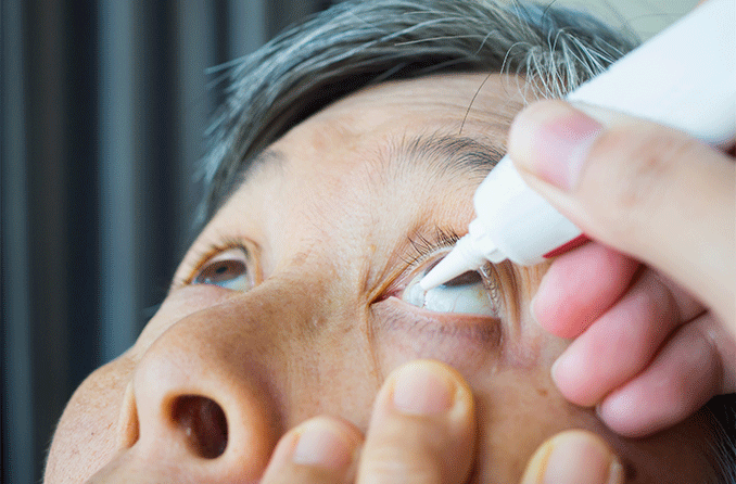 青光眼治療:眼藥水及藥物 | 視力健康網