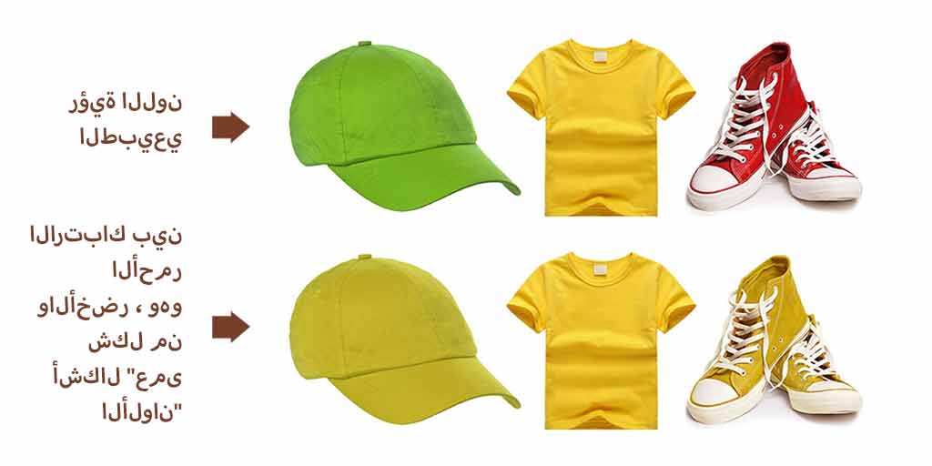 عمى الألوان، أنواع عمى الألوان