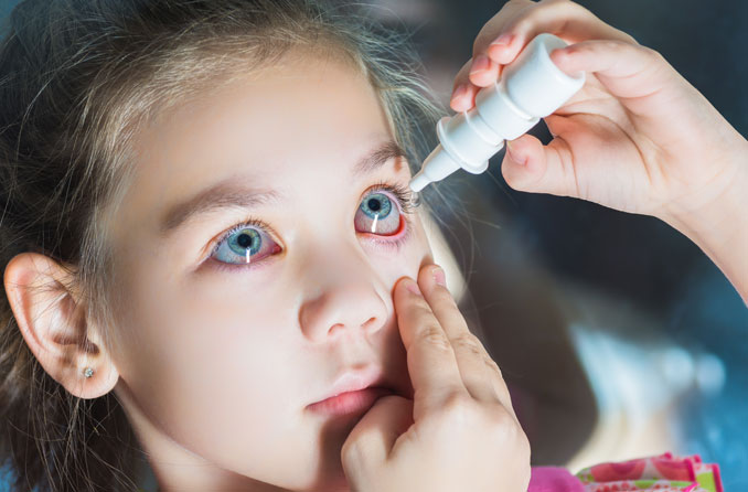 Meilleures gouttes ophtalmiques pour les allergies