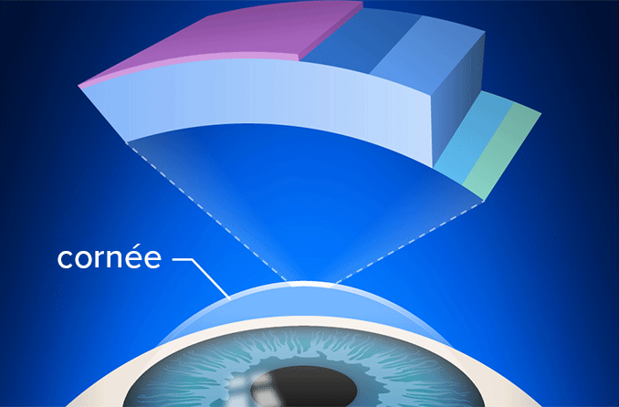 Dystrophie cornéenne de Fuchs : Causes, symptômes, risques et traitement