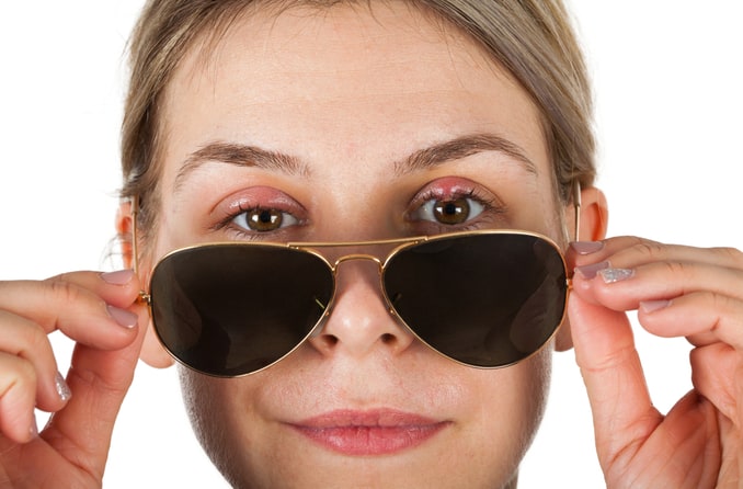 Les orgelets sont-ils contagieux ?