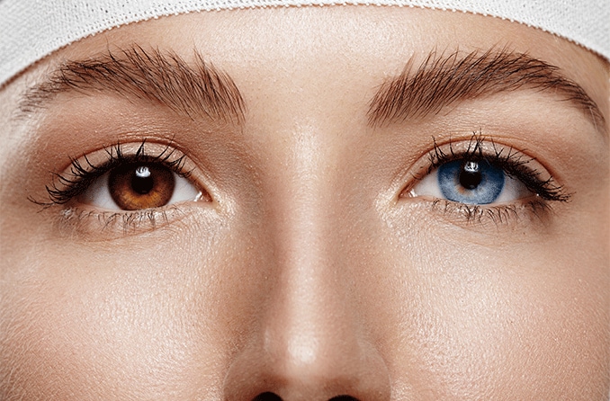Changer la couleur des yeux par chirurgie : est-ce dangereux ?