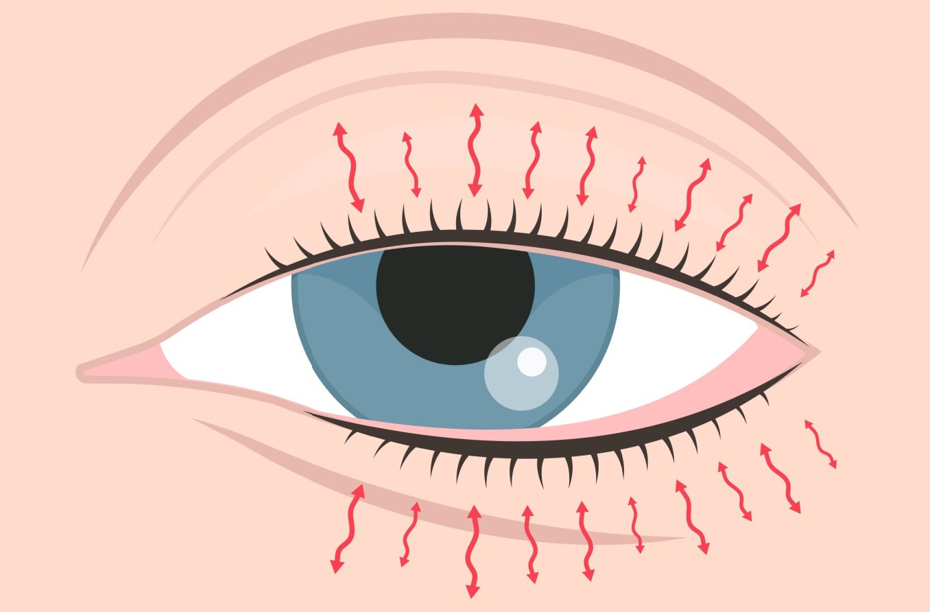 Blepharospasm: Symptoms, causes and treatment
