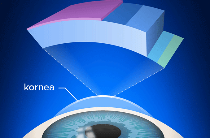 Fuchs korneal distrofisi: Nedenleri, semptomları ve tedavisi