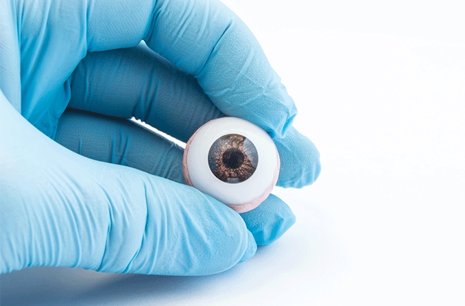 Transplante de olhos