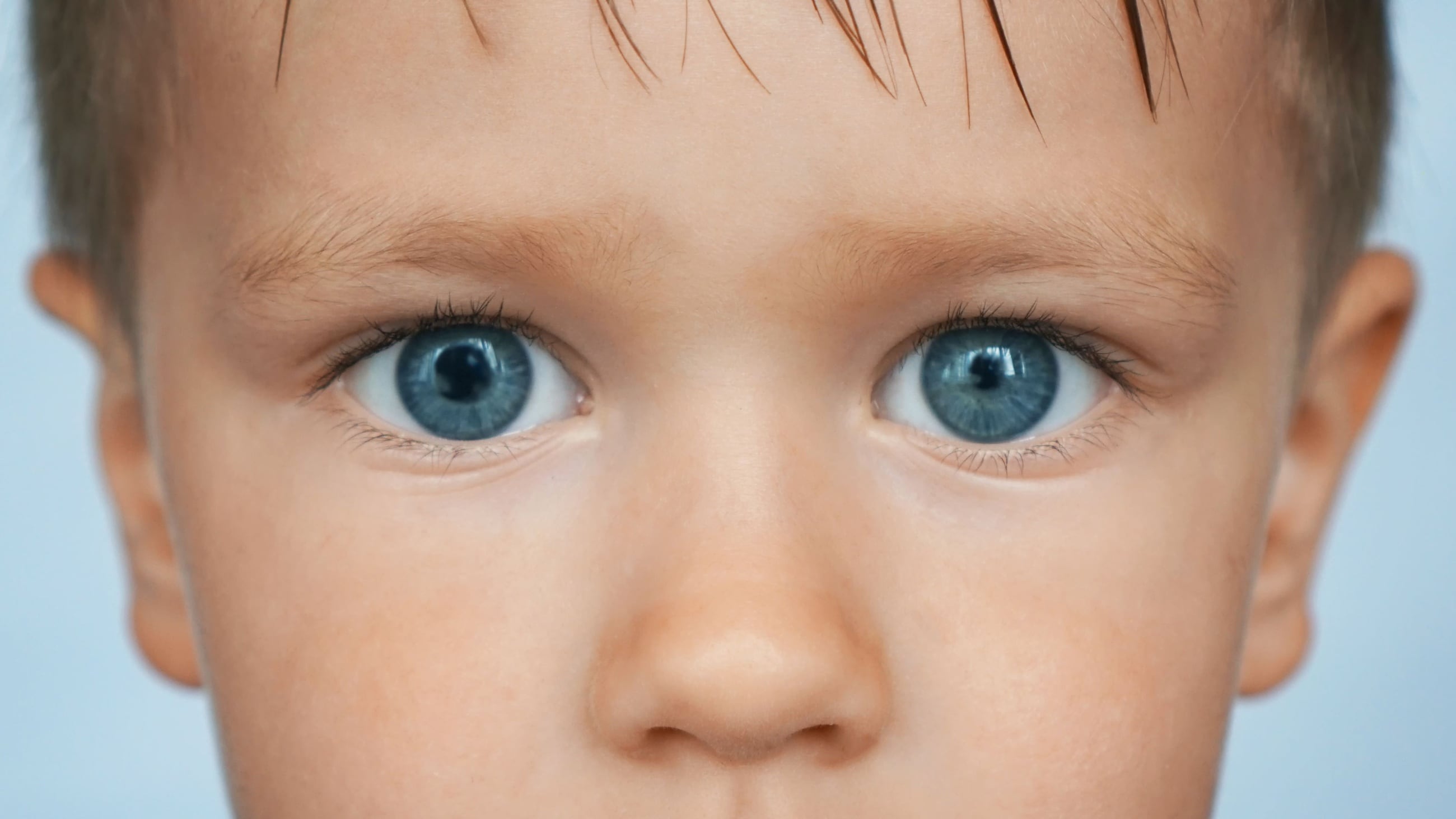 bambino con anisocoria bambino con anisocoria