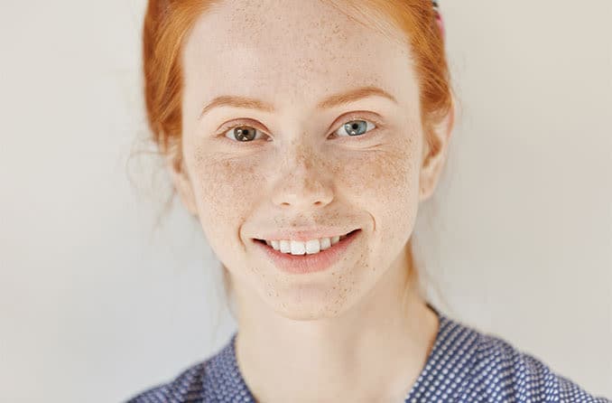 Heterochromia is having different-colored eyes Heterochromia is having different-colored eyes