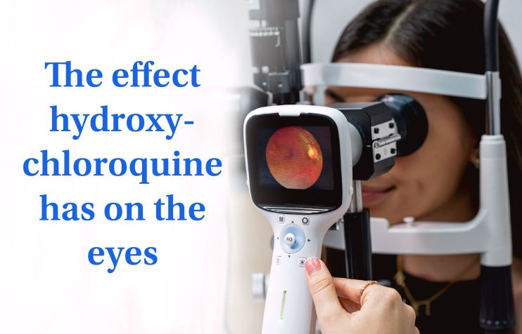 The effect hydroxychloroquine has on the eyes