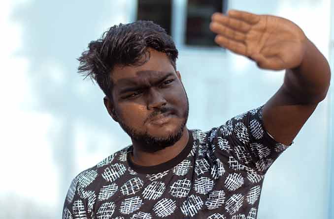 फोटोफोबिया: प्रकाश संवेदनशीलता के लक्षण और कारण