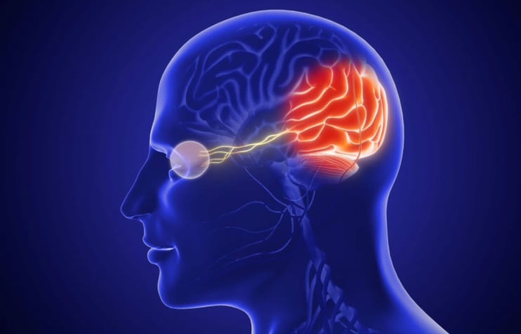 Cerebral Visual Impairment