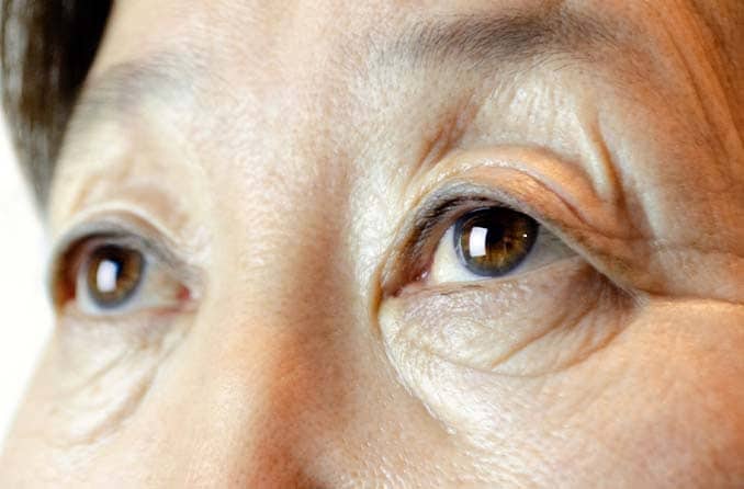 ตาสีน้ำตาลแดง: อะไรคือสิ่งที่กำหนดตาสีน้ำตาลแดง