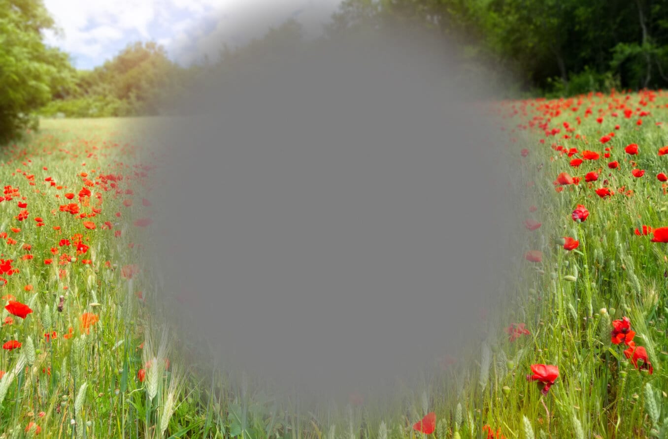 การมองเห็นของเด็กถูกบิดเบือนโดยผลกระทบจากภาวะจอประสาทตาเสื่อมที่เกี่ยวข้องกับอายุ