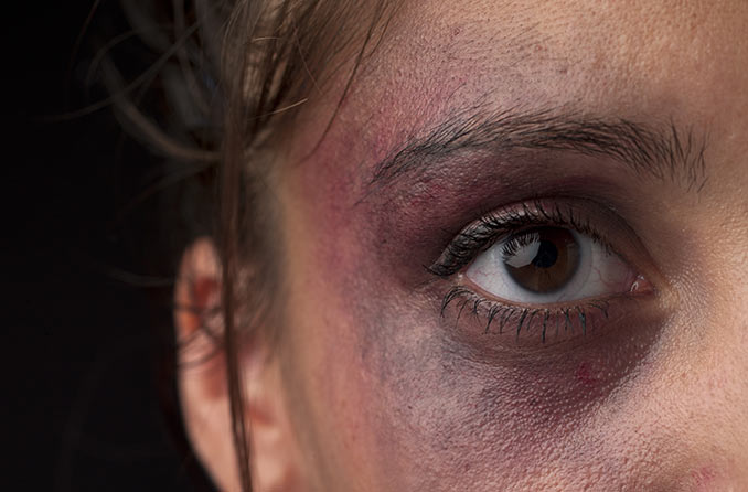 Cedera mata: Pengobatan trauma okular 