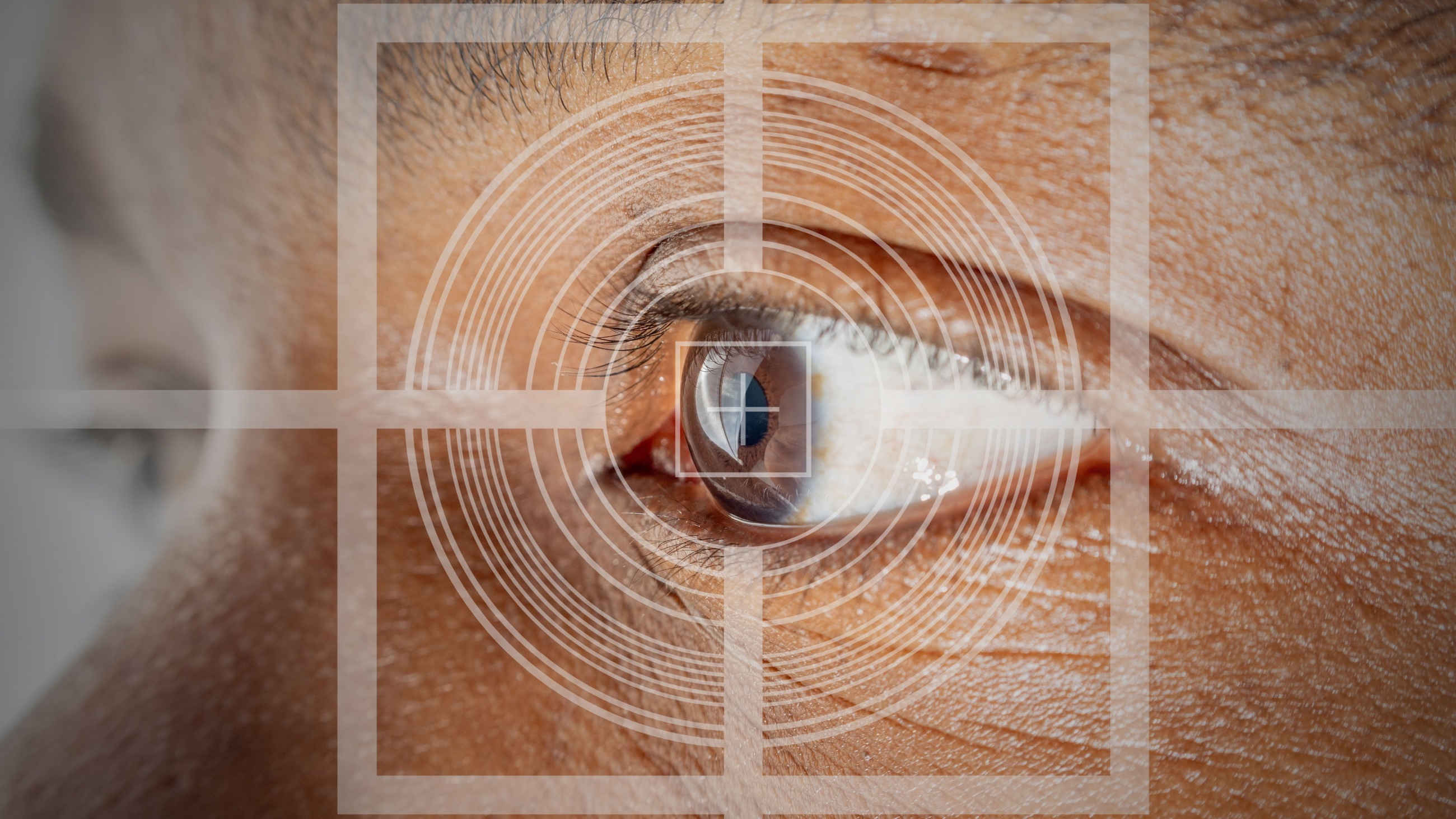 Lasik Eye Surgery