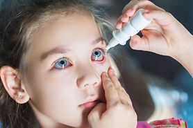 A girl uses eye drops for allergy relief