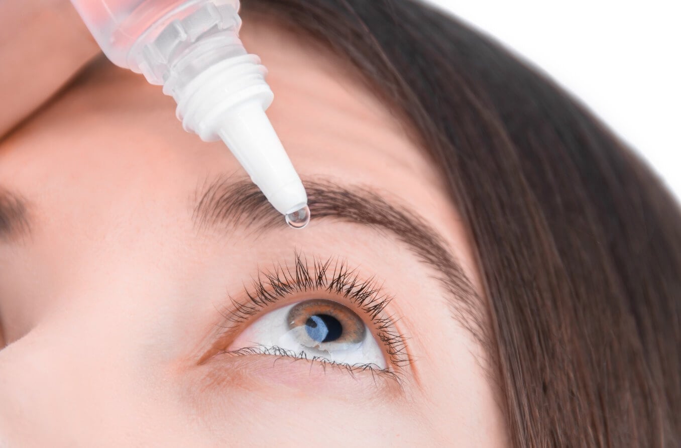 Young woman placing artificial tear into eye.