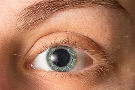 closeup of a woman's eyes after getting eye dilation exam