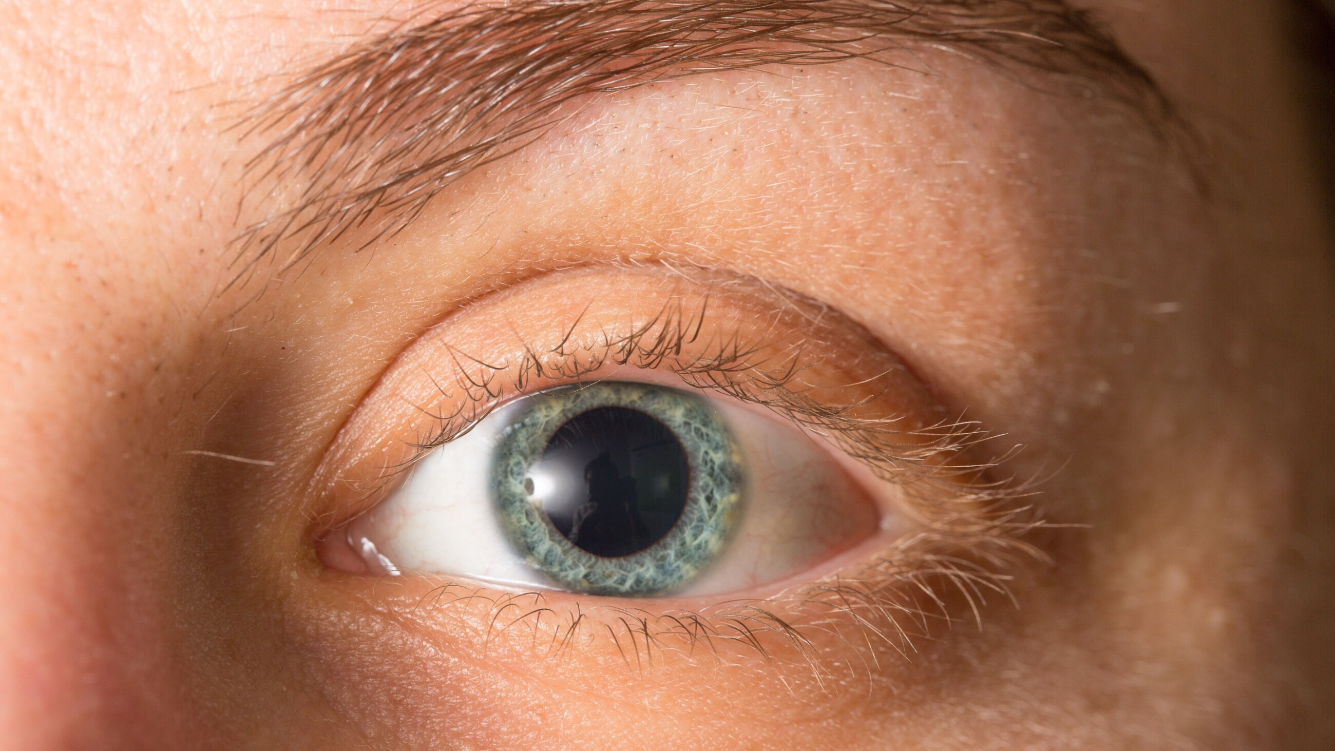 closeup of a woman's eyes after getting eye dilation exam
