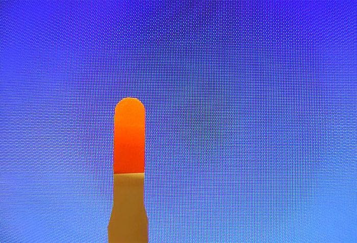 What is a fluorescein eye stain test?