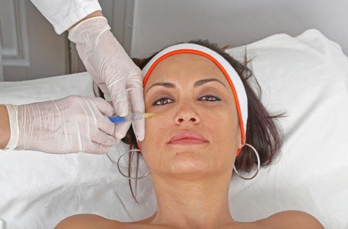 Woman with dark hair and brown eyes is lying back to receive under-eye filler injections. Woman with dark hair and brown eyes is lying back to receive under-eye filler injections.