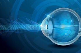 eye diagram