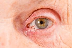 closeup of an eye with tear drop