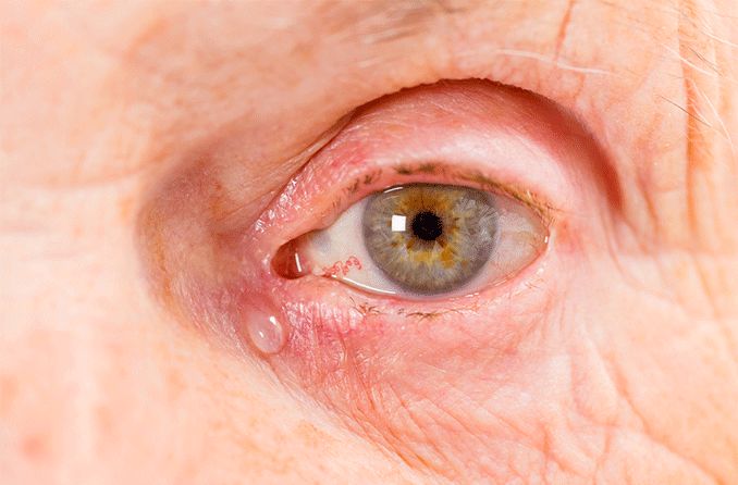 closeup of an eye with tear drop