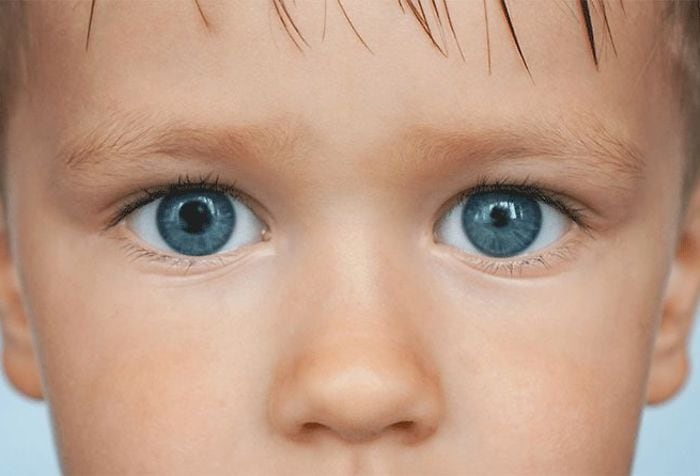 Anisocoria: What causes unequal pupil sizes?