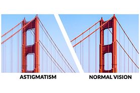 astigmatism vs. normal vision
