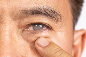 normal eye vs eye with cataract