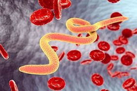 river blindness (Onchocerciasis) worms