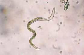 Toxocariasis parasite