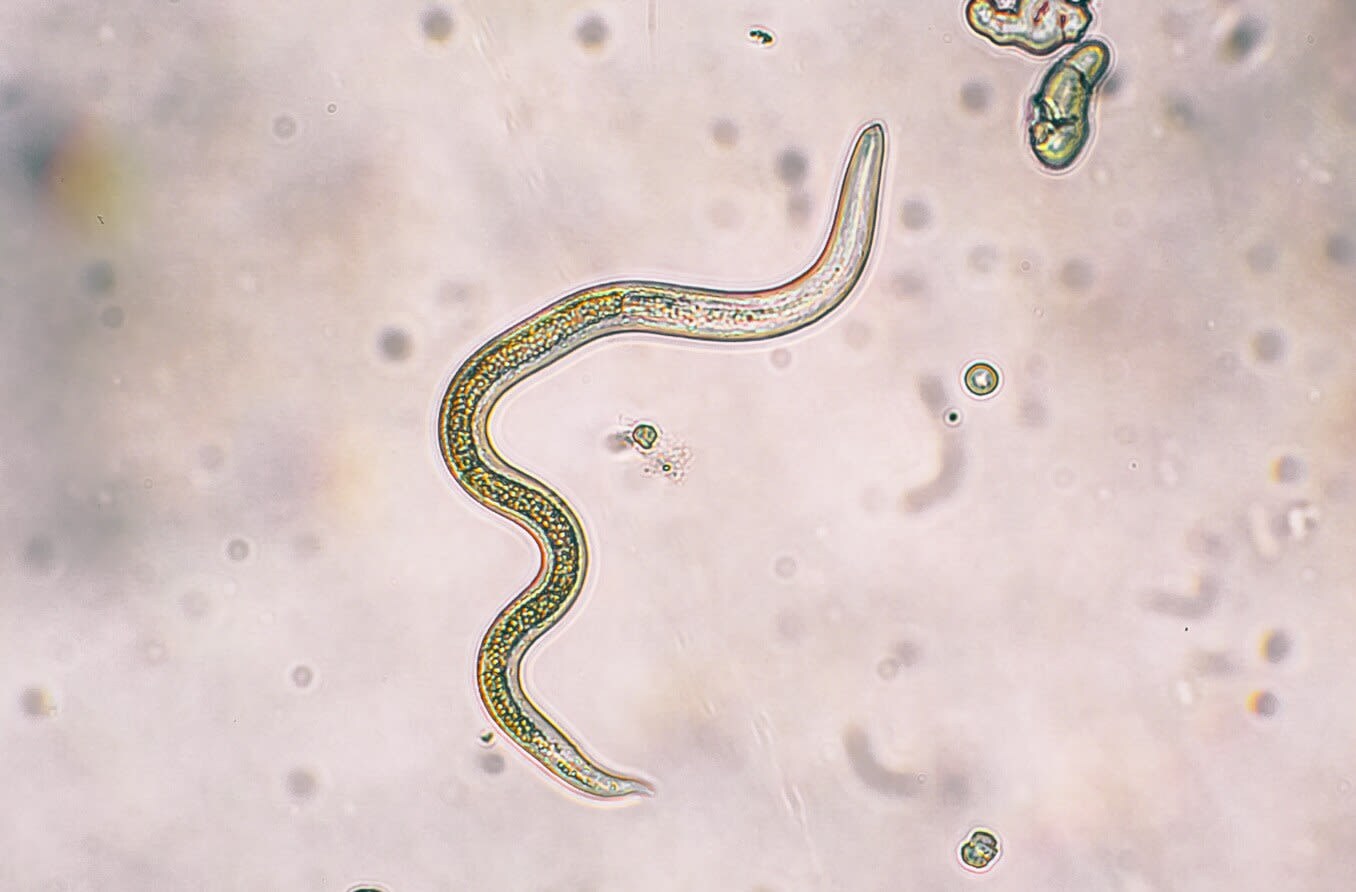 Toxocariasis parasite Toxocariasis parasite