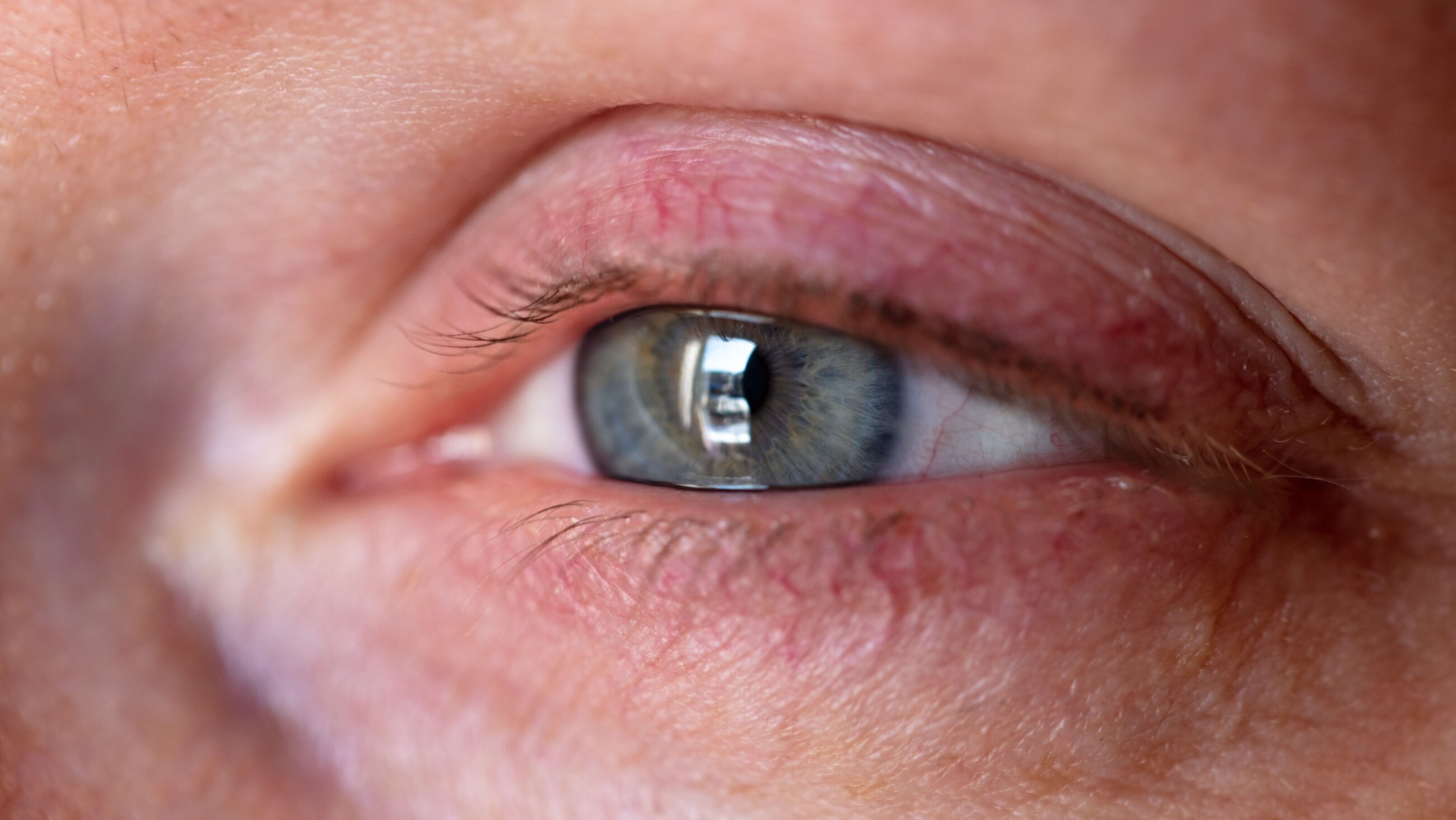 Teary eye looking out the window.