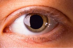 closeup of a dilated pupil or blown pupil
