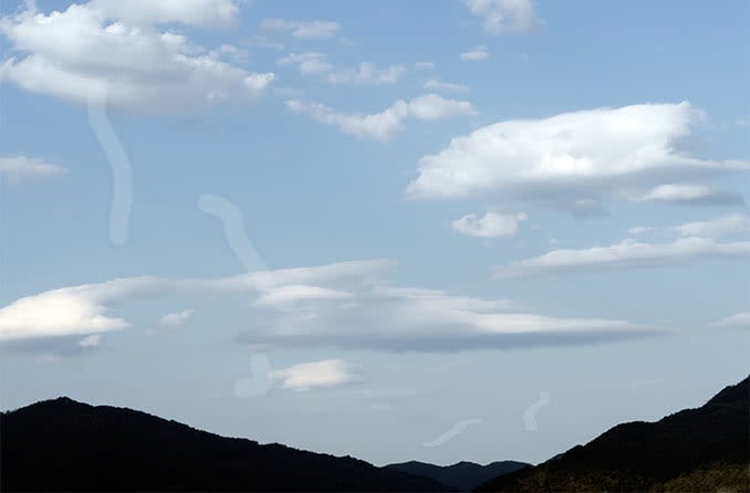 view of eye floaters in the eye after eye surgery view of eye floaters in the eye after eye surgery