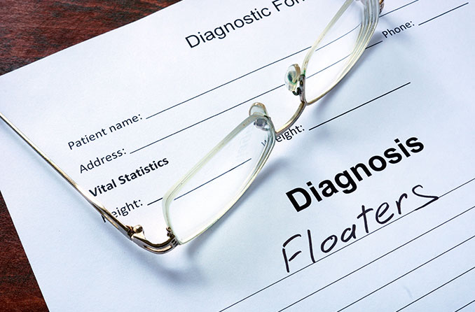 eye floaters doctor diagnosis eye floaters doctor diagnosis
