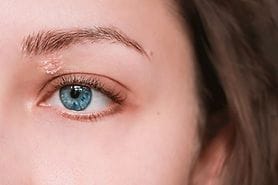 girl with psoriasis on upper eyelid