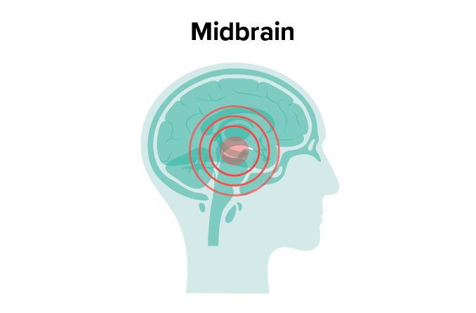 illustration of the midbrain - where Parinaud syndrome occurs