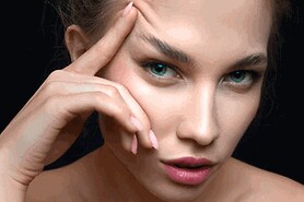 woman with canthoplasty cat eye surgery