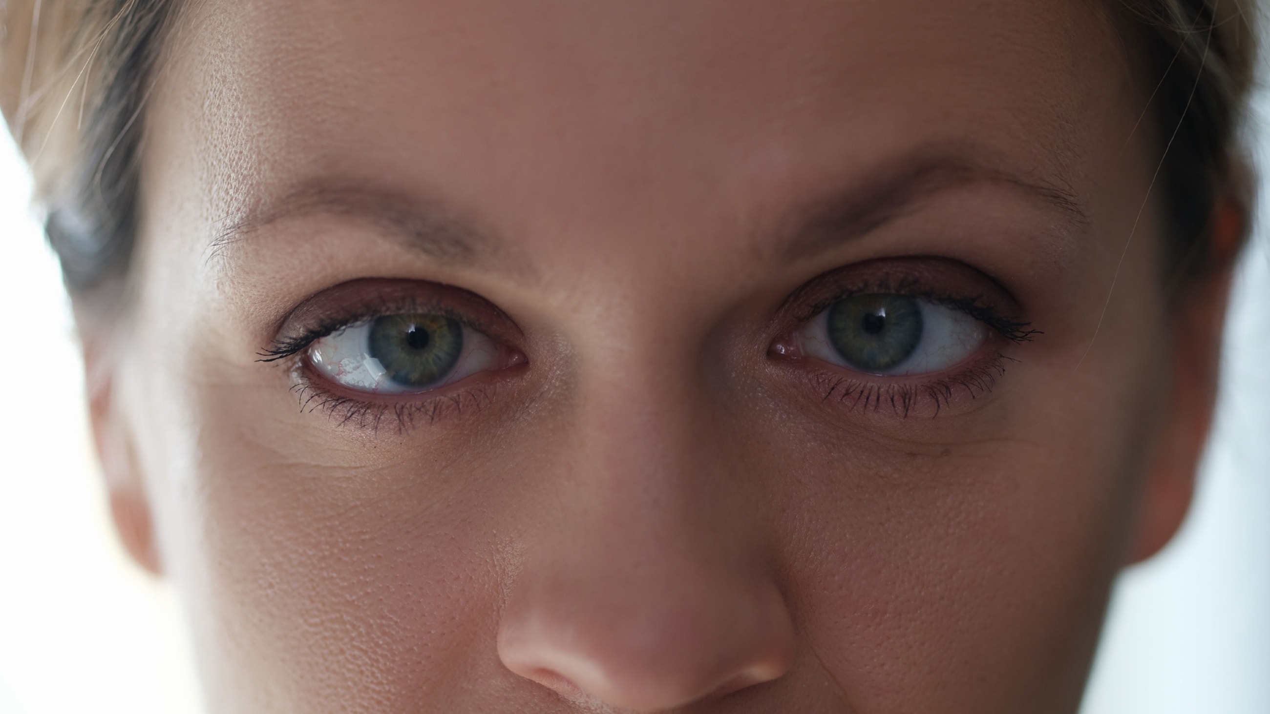 Portrait of young beautiful woman with lazy eyes.