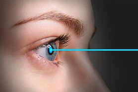 Bladeless LASIK: Femtosecond laser eases LASIK fears Bladeless LASIK: Femtosecond laser eases LASIK fears
