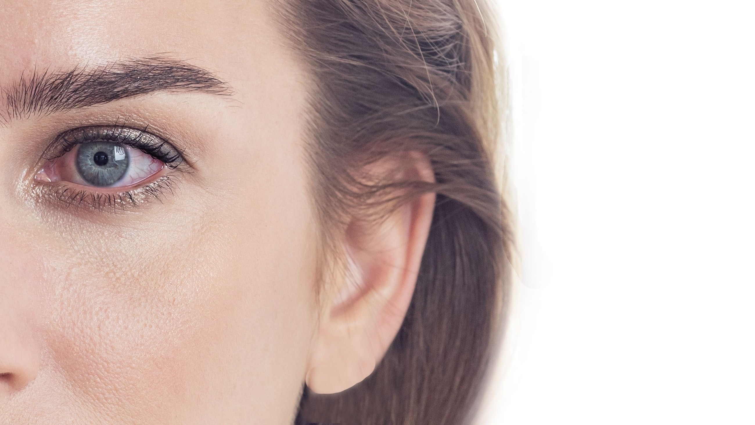Dry eye syndrome, female red eye with inflamed vessels close-up on a white background.